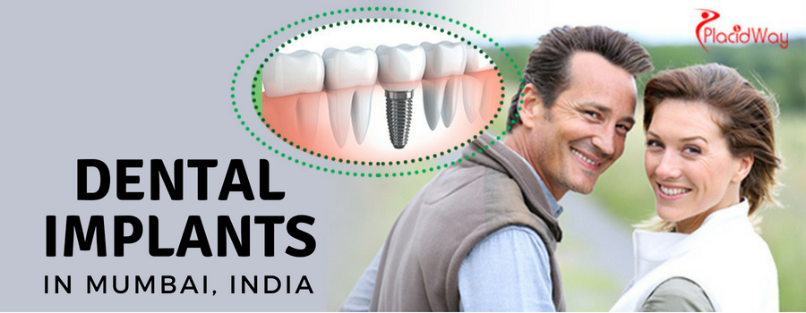 Dental Implants in Mumbai, India